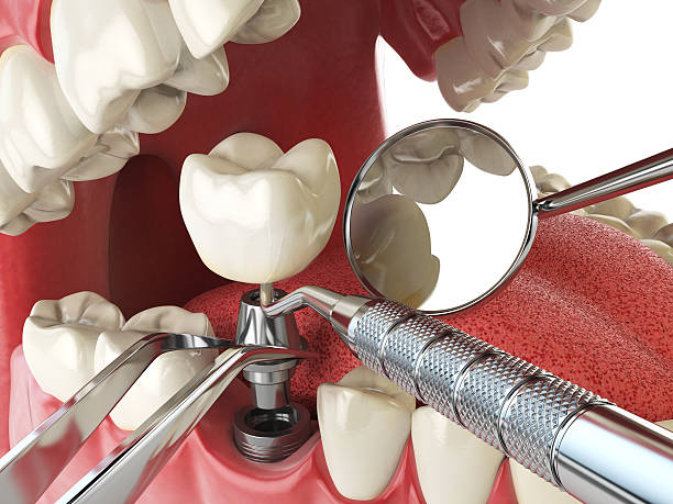 Best Emergency Treatment for Toothache in Kaumakani, HI